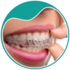 botao-A-aparelhos-invisiveis-ortodontia-aparelhos-invisiveis-dra-sandra-vicente-barra-da-tijuca-clinica-faceortoto-ortodontia-invisalign-aparelhos-invisiveis2