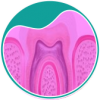 botao-A-endodontia-remocao-de-pino-intracanal-tratamento-de-canal-sem-dor-dra-sandra-vicente-barra-da-tijuca-clinica-faceortoto-ortodontia-dentista-no-casa-shopping